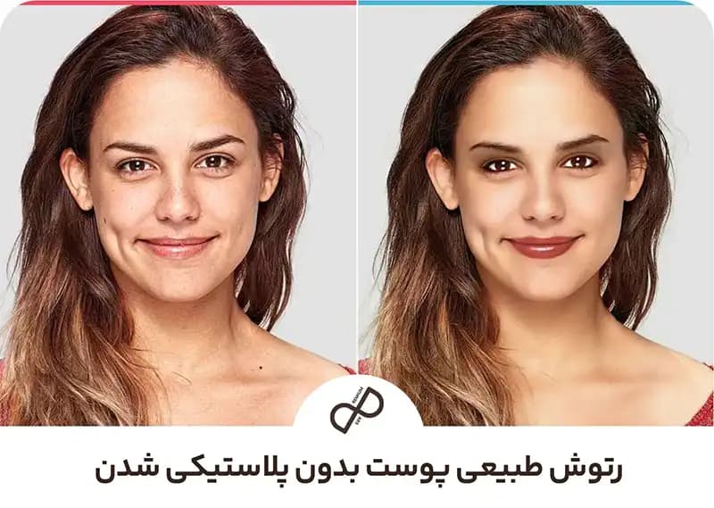 رتوش طبیعی پوست بدون پلاستیکی شدن
